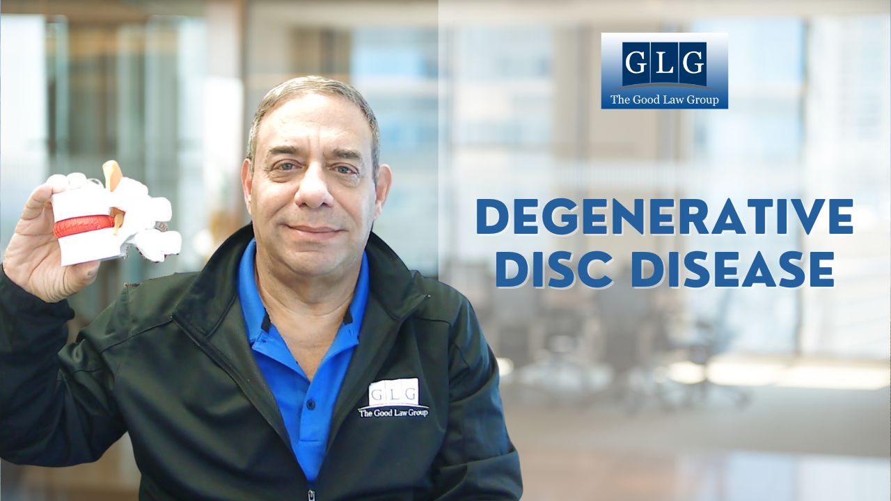 SSD - Degenerative Disc Disease